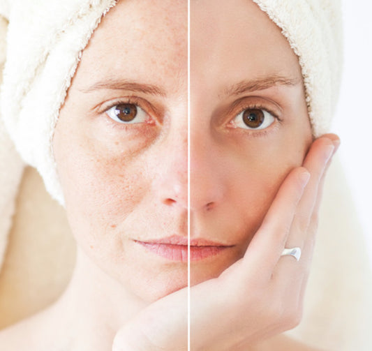 Anti-Aging Collagen Facial